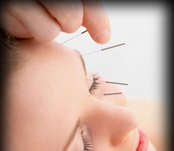 acupuncture treatment 1